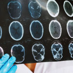 brain-scan